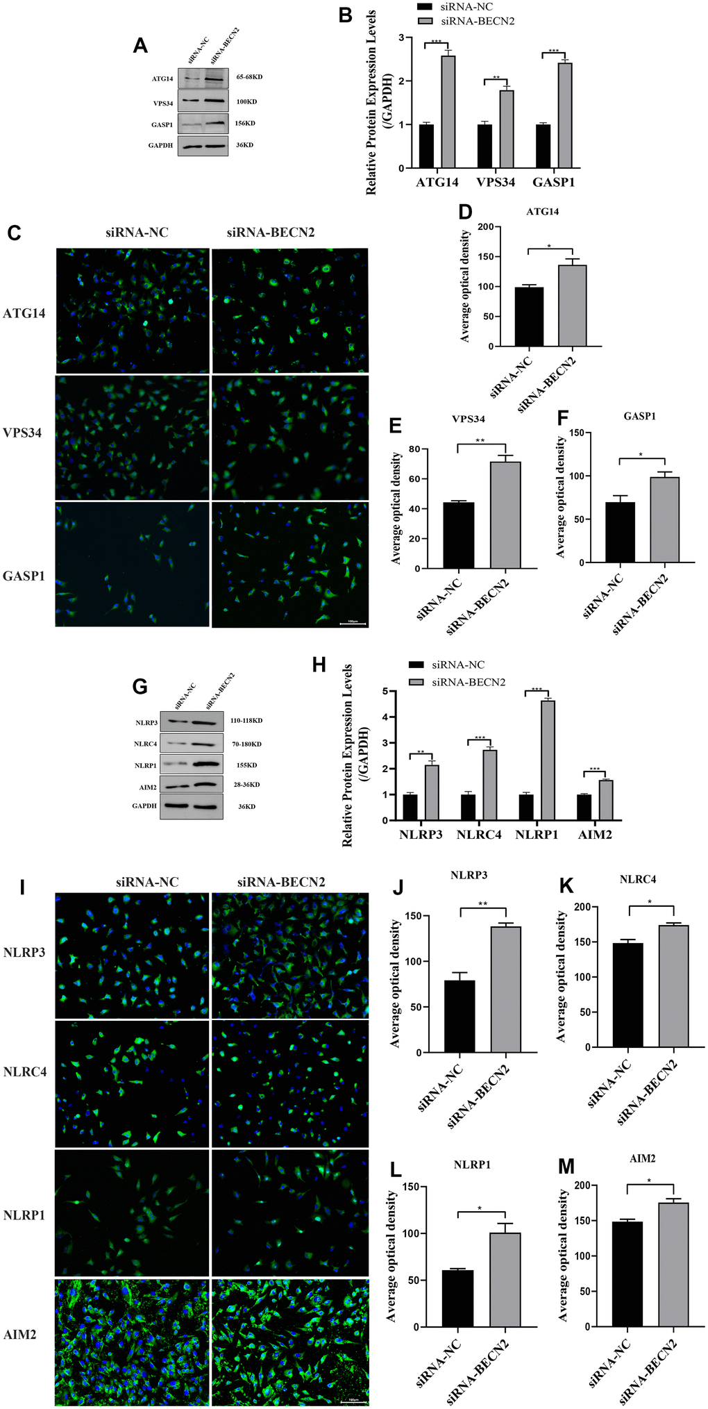 Decreased BECN2 activated the autophagy and inflammation of ATDC5. (A) Western blot was employed to detect the expression of ATG14, VPS34 and GASP1. (B) The protein expression of ATG14, VPS34 and GASP1 were determined using ImageJ software, GAPDH was used as the internal control, respectively (n=3). (C) ATG14, VPS34 and GASP1 expression were determined by immunofluorescence staining (scale bar: 100μm). (D–F) Average optical density was calculated by ImageJ software. (G) Western blot was employed to detect the expression of NLRP3, NLRC4, NLRP1 and AIM2. (H) The protein expression of NLRP3, NLRC4, NLRP1 and AIM2 were determined using ImageJ software, GAPDH was used as the internal control, respectively (n=3). (I) NLRP3, NLRC4, NLRP1 and AIM2 expression were determined by immunofluorescence staining (scale bar: 100μm). (J–M) Average optical density was calculated by ImageJ software. All data represent mean ± SD. All in vitro experiments were repeated three times independently. * p p p 
