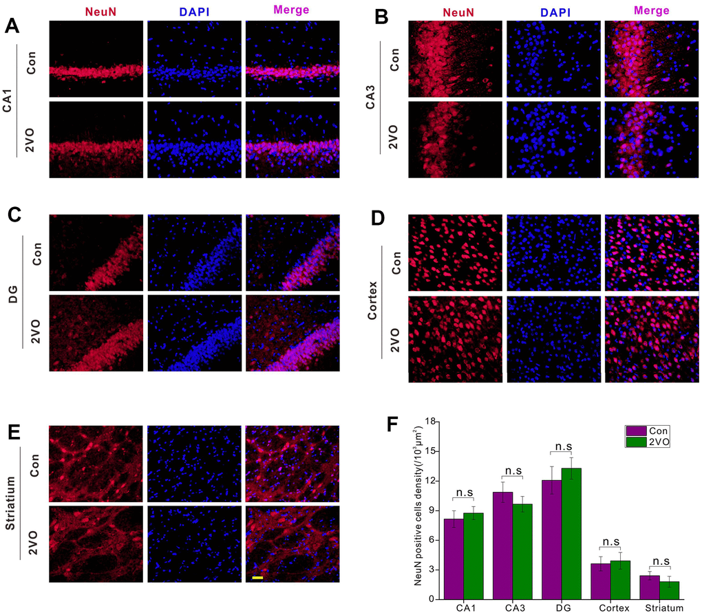 The neuronal densities in different regions of the brain were evaluated with the immunofluorescent NeuN-labeled staining. (A) CA1, (B) CA3, (C) DG, (D) Cortex, (E) Striatium regions were stained with NeuN antibody and DAPI. The red and blue staining indicated the NeuN-labeled neurons and the nucleus, respectively. The purple indicated the merge of both. (F) Count of NeuN-labeled neurons in different regions. Scale bar=10μm. [(Con group, n=3), (2VO group, n=3)].
