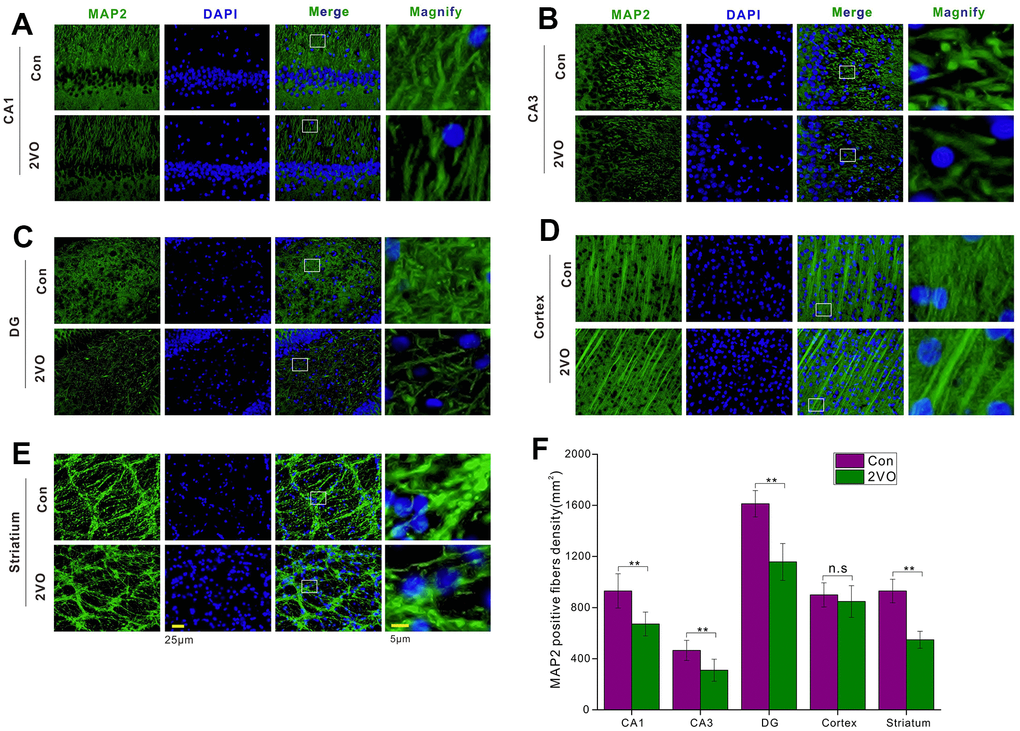 The neuronal fiber density in different regions of the brain was evaluated with the immunofluorescent MAP2-labeled staining. (A) CA1, (B) CA3, (C) DG, (D) Cortex, (E) Striatum regions were stained with MAP2 antibody and DAPI. The green and blue staining indicated the MAP2-labeled neuronal fibers and the nucleus, respectively. (F) The density of MAP2-labeled neuronal fibers in different regions. Scale bar = 25μm. The scale bar in the magnified image = 5μm. [(Con group, n=3), (2VO group, n=3)].