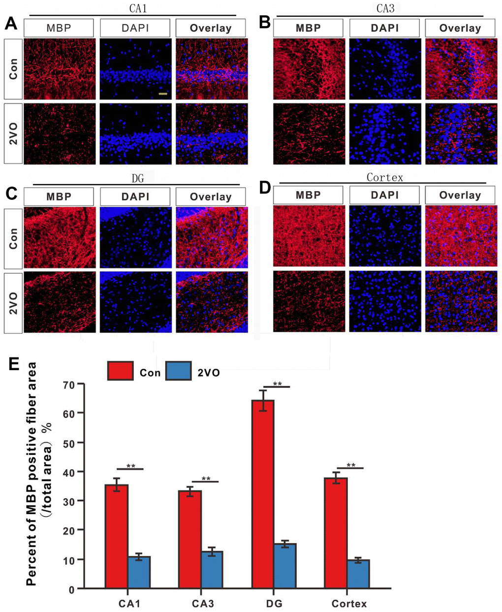 The degree of myelination of neuronal fibers in different regions of the brain was evaluated with the immunofluorescent MBP-labeled staining. (A) CA1, (B) CA3, (C) DG, and (D) Cortex regions were stained with MBP antibody and DAPI. The red and blue staining indicated the MBP-labeled neuronal fibers and the nucleus, respectively. (E) Percentage of the MBP-positive fiber area in various regions. Scale bar = 25μm. [(Con group, n=3), (2VO group, n=3)].