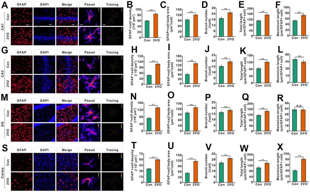 The astrocyte profiles in different regions of the brain were evaluated with the immunofluorescent GFAP-labeled staining. (A) astrocytes in CA1 were shown with GFAP antibody staining. (B) density, (C) body area, (D) branch number, (E) total projection length, and (F) maximum length of GFAP-positive cells were analyzed. (G) astrocytes in CA3 were shown with GFAP antibody staining. (H) density, (I) body area, (J) branch number, (K) total projection length, and (L) maximum length of GFAP-positive cells were analyzed. (M) astrocytes in the DG were shown with GFAP antibody staining. (N) density, (O) body area, (P) branch number, (Q) total projection length, and (R) maximum length of GFAP-positive cells were analyzed. (S) astrocytes in the cortex were shown with GFAP antibody staining. (T) density, (U) body area, (V) branch number, (W) total projection length, and (X) maximum length of GFAP-positive cells were analyzed. Scale bar=25μm. The scale bar in the magnified image=5μm. [(Con group, n=3), (2VO group, n=3)].