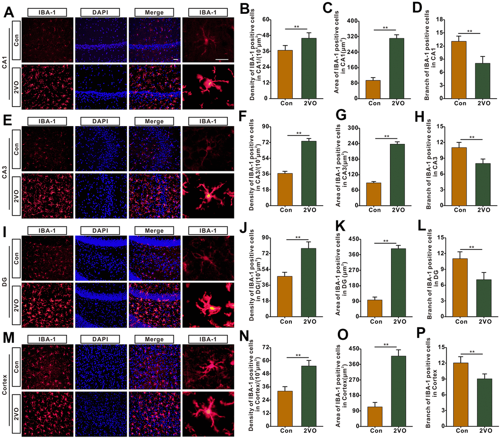 The microglia profiles in different regions of the brain were evaluated with the immunofluorescent (IBA-1)-labeled staining. (A) Microglia in CA1 were shown with IBA-1 antibody staining. (B) density, (C) body area and (D) branch number of IBA-1 positive cells were analyzed. (E) Microglia in CA3 were shown with IBA-1 antibody staining. (F) density, (G) body area and (H) branch number of IBA-1 positive cells were analyzed. (I) Microglia in DG were shown with IBA-1 antibody staining. (J) density, (K) body area and (L) branch number of IBA-1 positive cells were analyzed. (M) Microglia in the cortex were shown with IBA-1 antibody staining. (N) density, (O) body area and (P) branch number of IBA-1 positive cells were analyzed. Scale bar = 25μm. The scale bar in magnified image = 5μm. [(Con group, n=3), (2VO group, n= 3)].