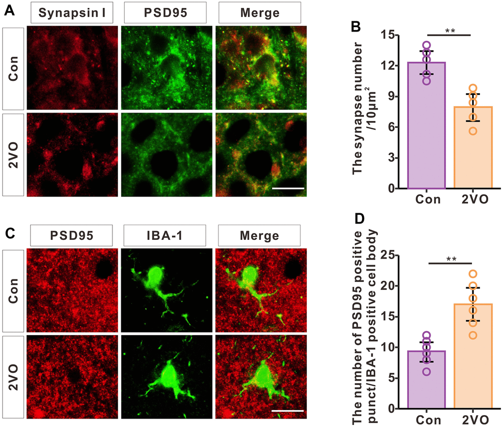 CCH induces the loss of synapses and increased phagocytosis of synapses by microglia. (A) Brain slices of the hippocampus were stained with synapsin and PSD95 antibodies to show the synapses. (B) The density of synapses was analyzed (n=5). (C) Brain slices of the hippocampus were stained with PSD-95 and IBA-1 antibodies to show the engulfing of synapses by microglia. (D) The PSD-95 positive punctation number of microglia’s cell body was analyzed (n=6). Scale bar = 2.5μm.