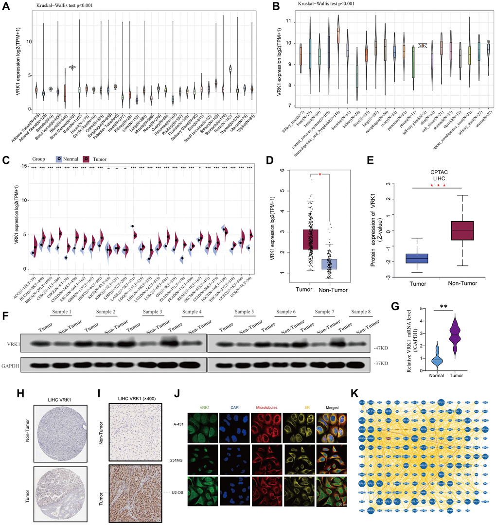 Basic information of VRK1 expression. (A) The different VRK1 expressions of the 31 types of cancers. (B) The different VRK1 expression in the cancer cell lines. (C) Comparison of VRK1 mRNA levels between cancerous and adjacent normal tissue from TCGA and GTEx datasets. (D) The mRNA level of VRK1 between LIHC and normal tissues. (E) The protein expression level of VRK1 between LIHC and normal tissues. (F, G) Western blotting and qRT-PCR assays explored the protein and mRNA expression level of VRK1 in the LIHC tissues and paired normal tissues. GAPDH was used as a loading control. (H, I) The expression level of VRK1 was detected using public databases and collected liver cancer tissue specimens by using IHC assay. (J) The immunofluorescence images of VRK1 protein, nucleus, endoplasmic reticulum (ER), microtubules, and the incorporative images in A-431, U-251MG, and U2-OS cell lines. (K) Protein–protein interactions of diagram of VRK1 protein (*P **P ***P 