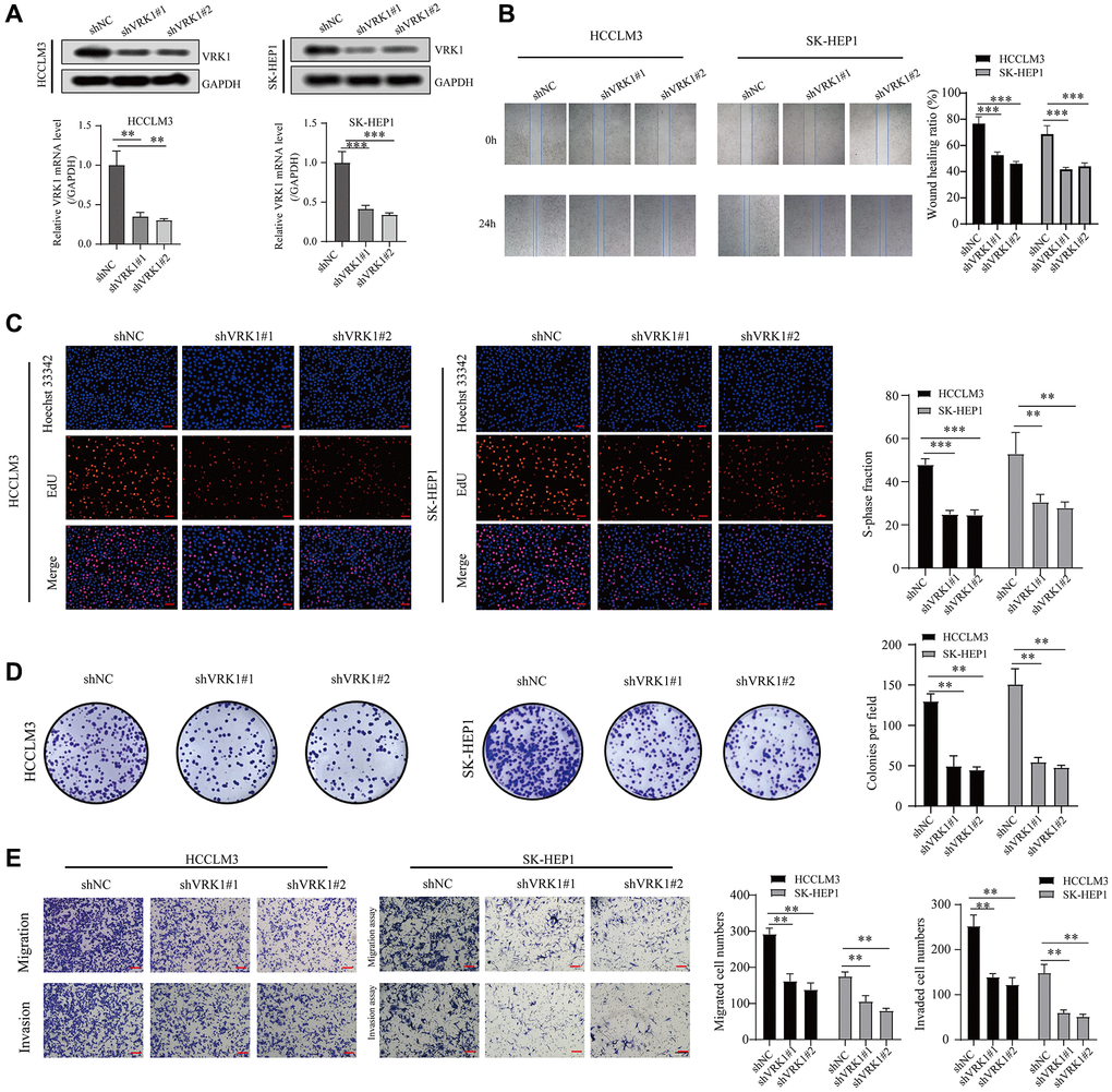 VRK1 promotes HCC cell proliferation and invasion. (A) The protein and mRNA expression levels of VRK1 in HCC cells after transfection with shVRK1 or shNC. (B) Statistical plots and representative images of the wound healing assay in HCC cells transfected with shVRK1. (C) Representative images and quantification of Edu assay in HCC cells transfected with shVRK1. (D) Colony formation assays detecting the cell proliferation in HCC cells transfected with shVRK1. (E) Transwell assays show the suppressed migration and invasion ability of HCC cells transfected with shVRK1 (*P **P ***P 