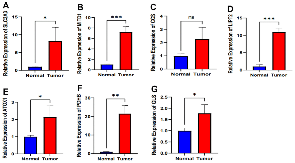 Validation of expression of 7 CRGs in ESCA tissues using qRT-PCR. (A–G) The expression levels of the 7 CRGs in 10 pairs ESCA tissues and corresponding adjacent normal tissues were examined by qRT-PCR. ns, not significant, *P P P 