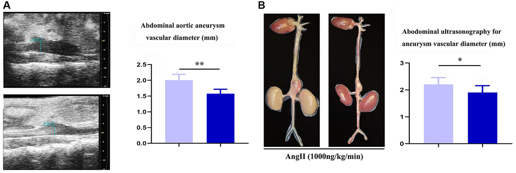 Specific deficiency of notch-1 in macrophage suppressed the progression of AAA. (A) representative aortic images with identical magnification and quantitative analysis; (B) two-dimensional B-mode high-resolution ultrasonography and quantitative analysis. N = 9, *P **P MAC-KO group vs. apoE-KO/Notch-1WT group.