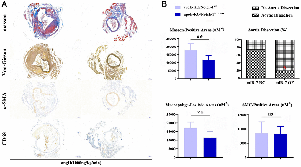 Notch-1-cKO in macrophages inhibited the elastic lamina degradation and macrophages infiltration in AAA. (A) representative image for Masson’s staining, α-SMA staining, CD68 immunostaining, and Verhoeff-van Gieson staining; (B) statistical data for AAA areas, macrophages, smooth muscle cells as well as ratio of aortic dissection. N = 9, *P **P MAC-KO group vs. apoE-KO/Notch-1WT group.