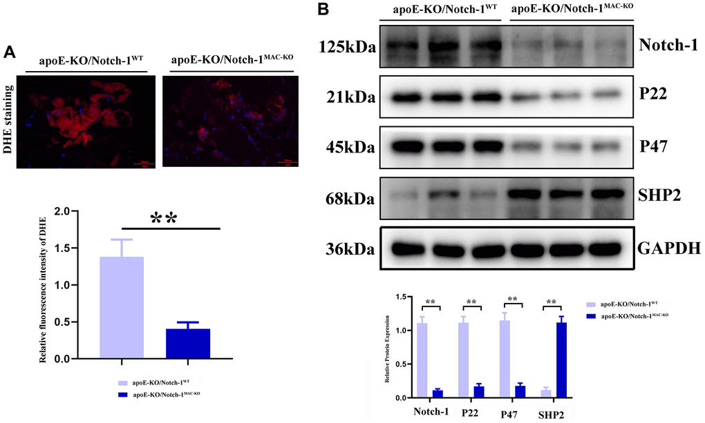 Notch-1 cKO in macrophages increased the SHP2 and suppressed the ROS in AAA. (A) DHE staining results showed the macrophages’ deficiency of Notch-1 suppressed the ROS production and its statistical data. N = 9; (B) macrophages’ deficiency of Notch-1 suppressed the expression of Notch-1, p22, p47 and consistent with increased expression of SHP2 in AAA tested by western blot. *P **P MAC-KO group vs. apoE-KO/Notch-1WT group.