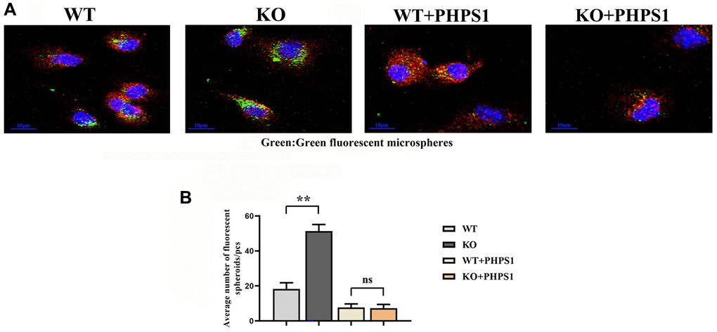 Monocytes/macrophages-specific knockout of Notch1 promotes phagocytic capacity by promoting the SHP2 signaling pathway. (A) Immunofluorescent spheroid phagocytosis experimental results; (B) Macrophage engulfs fluorescent spheroid count statistics. N = 3, **P 