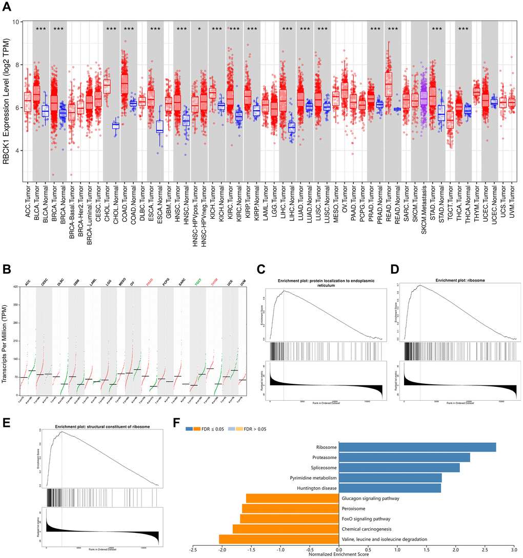 RBCK1 is overexpression in cancers. (A, B) RBCK1 expression in different type of cancers (TIMER2 database) and tissue (GEPIA2 database). (C–E) the partial Go terms for biological process (C) cellular component (D) and molecular function (F). Enrichment analysis of KEGG pathway (E).