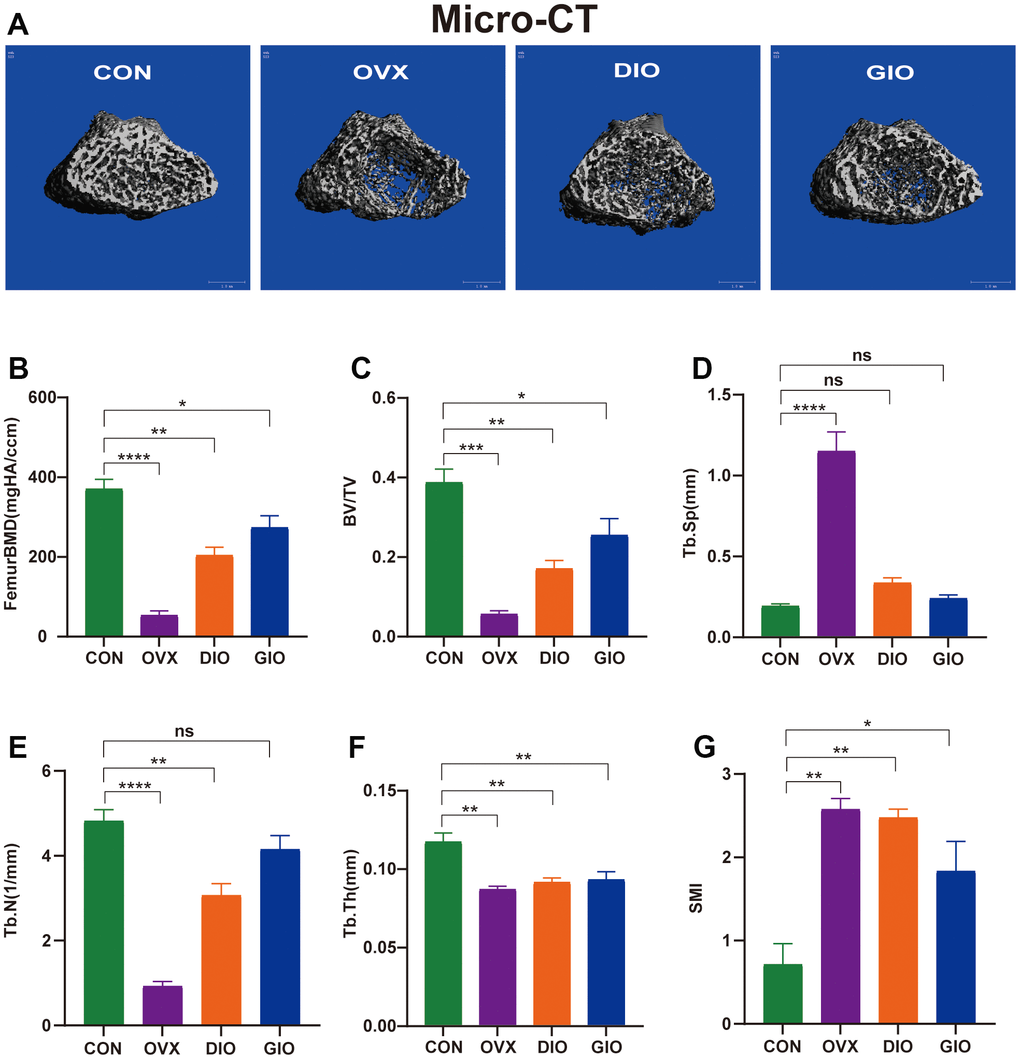 (A) Representative 3D micro-CT reconstructions of femurs from per group. (B–G) Trabecular bone at distal femoral metaphysis after 10 weeks. Parameters included BMD, BV/TV, Tb.Sp, Tb.N, Tb.Th, and SMI. Data are means ± standard error of the mean (SEM). n = 6, *P 