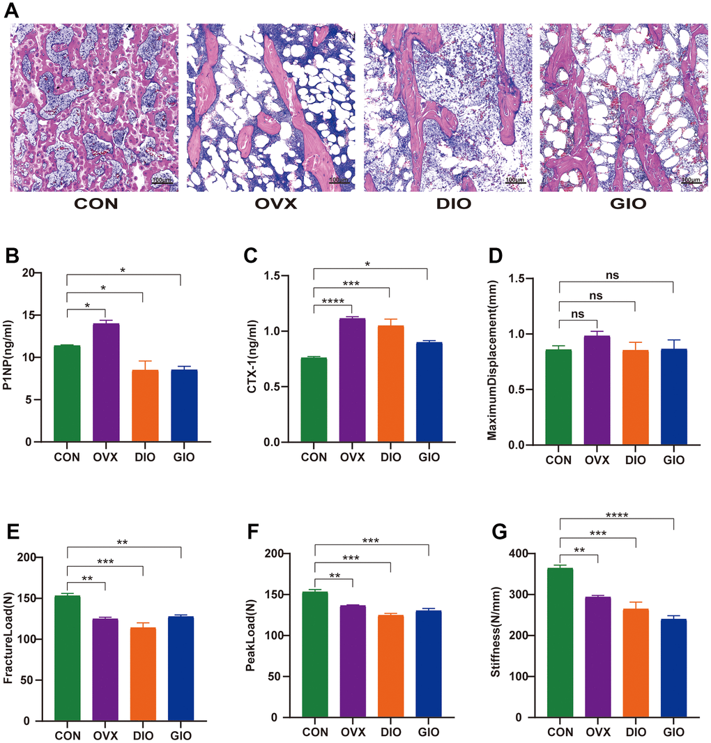 (A) Trabecular bone at distal femoral metaphysis observed by H&E staining. (B, C) Serum levels of bone turnover biomarkers including PINP and CTX-I. (D–G) Comparison of three-point bending test parameters including maximum displacement, fracture load, peak load, and stiffness. Data are means ± SEM. n = 6, *P 