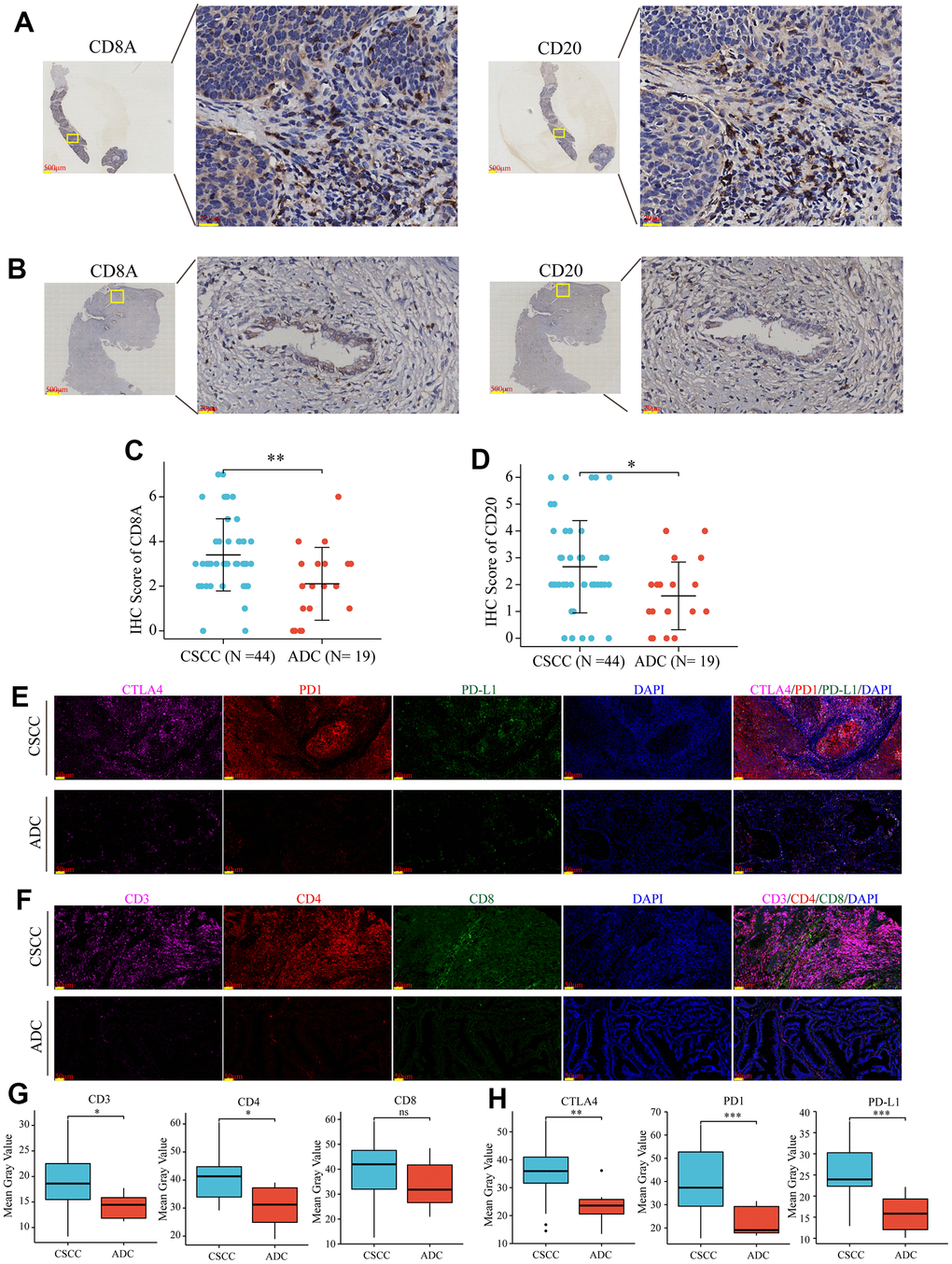 Verification of the levels of immunocytes infiltration and inhibitory immune checkpoints expression in collected CSCC and ADC samples. (A) Representative images of CD8A (T cells) and CD20 (B cells) in collected CSCC patients. (B) Representative images of CD8A (T cells) and CD20 (B cells) in collected ADC patients. (C, D) Statical charts displayed that CD8A (T cells) and CD20 (B cells) were more abundant in CSCC compared to ADC patients in our collected samples. (E, F) Representative staining of T cells (CD3/CD4/CD8) and inhibitory immune checkpoints (PD1/PD-L1/CTLA-4) in CSCC and ADC patients, respectively. (G, H) Statical charts displayed that T cells (CD3/CD4) and some immune inhibitory checkpoints (PD1/PD-L1/CTLA4) were more abundant in CSCC compared to ADC patients in our collected samples. * P ; ** P , *** P 