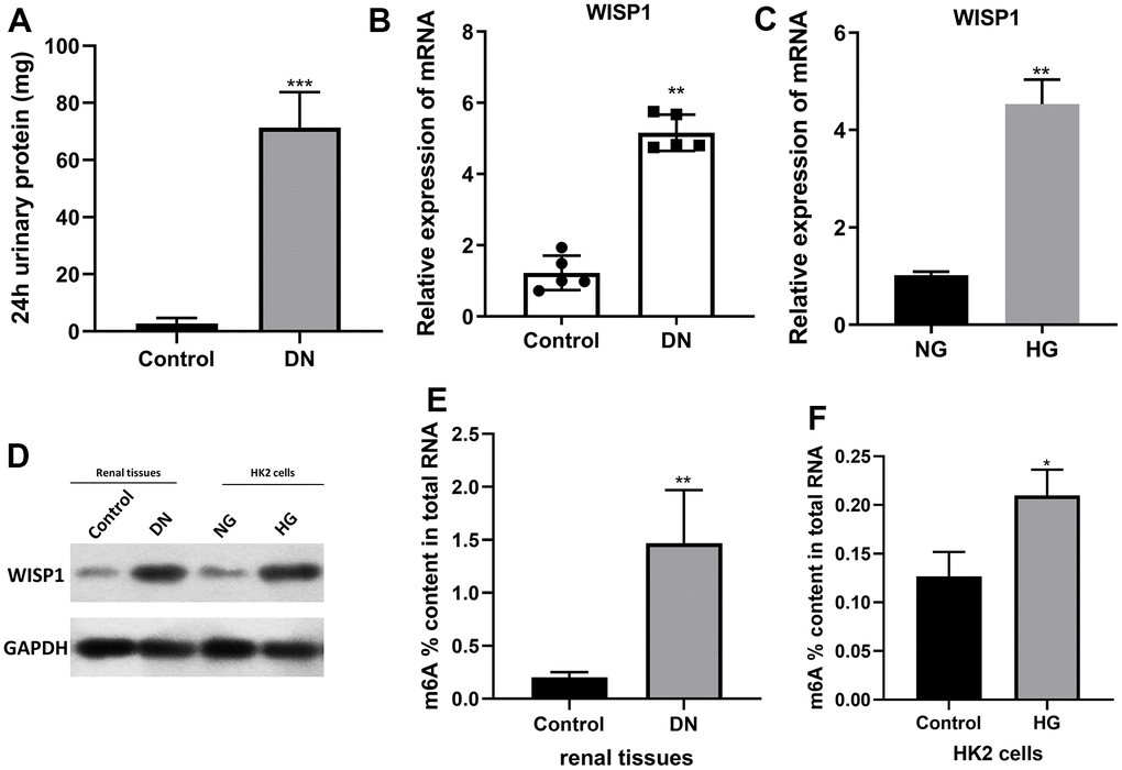 WISP1 expression was highly expressed in DN model mice and HG-treated HK2 cells. DN model mice were first established using streptozotocin. (A) 24-h urinary protein. (B) qRT-PCR analysis of WISP1 expression in kidney tissues which were removed from normal and DN mice (n=5). (C) QRT-PCR analysis of WISP1 expression in HG-treated HK2 cells. (D) The protein level expression of WISP1 in renal tissues and HK2 cells. (E) The total m6A RNA methylation context of total RNA between control and DN group. (F) The total m6A RNA methylation context of total RNA between control and HG group. *P P 
