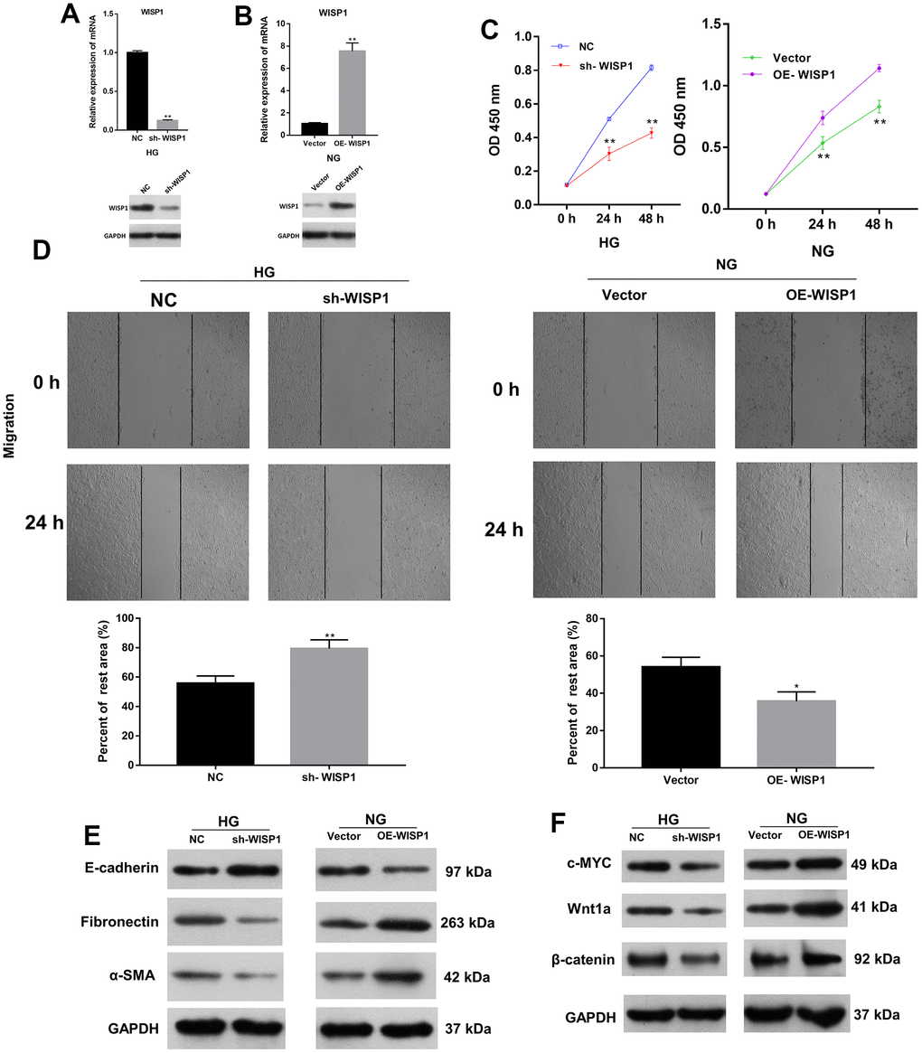 The impacts of WISP1 on the proliferation, migration, EMT, and renal fibrosis of HG-treated HK2 cells. (A) After HG treatment, the expression of WISP1 was confirmed using qRT-PCR and western blot in HK2 cells transfected with NC or sh-WISP1. (B) QRT-PCR and western blot analysis of WISP1 in HK2 cells transfected with OE-WISP1 or Vector. (C) CCK-8 assay for the assessment of cell proliferation in HG-induced HK2 cells with WISP1 silencing and HK2 cells with WISP1 overexpression. (D) Wound healing assay was conducted to identify the migration ability of the WISP1-silenced HG-induced HK2 cells and WISP1-overexpressed HK2 cells. (E) Western blot indicated the expression changes of E-cadherin, Fibronectin and a-SMA in WISP1-silenced HG-induced HK2 cells and WISP1-overexpressed HK2 cells. (F) The expressions of c-MYC, Wnt1 and β-catenin were monitored by applying western blot in each group. *P P 