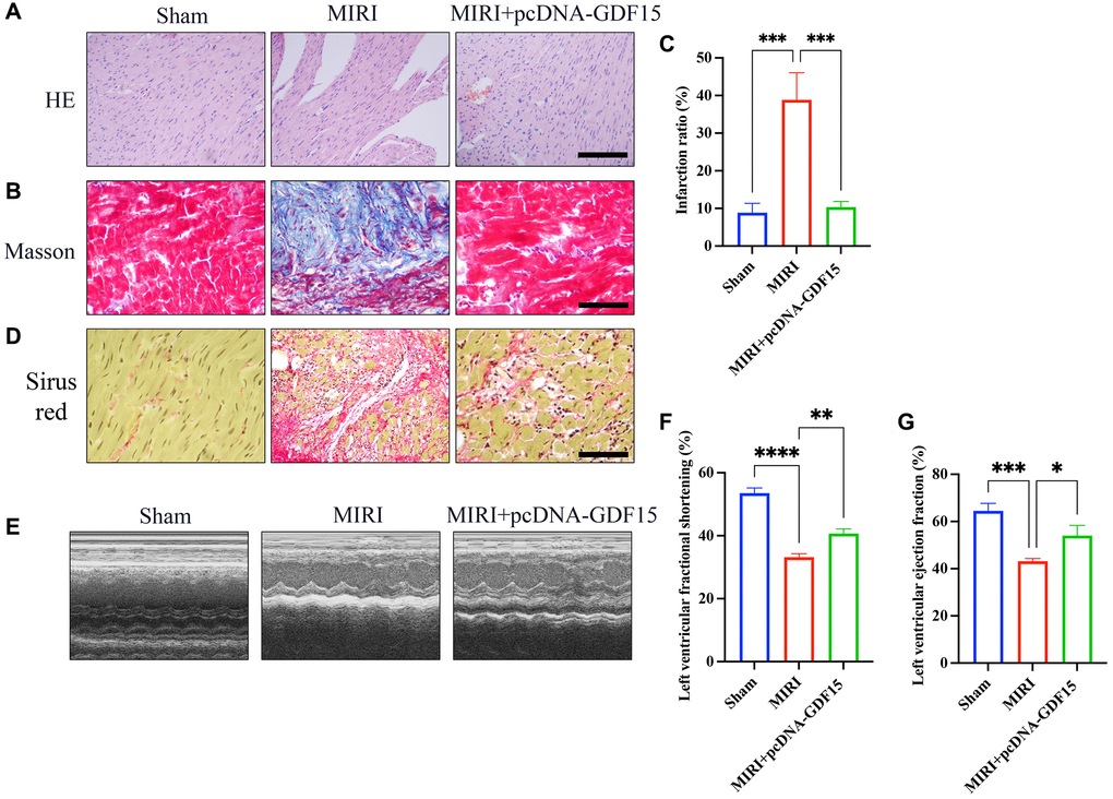 Overexpression of GDF15 greatly inhibited MIRI and improved cardiac function. (A) HE staining of cardiac tissues in different groups (bar: 200 μm, magnification: 100×); (B, C) Masson staining of cardiac tissues in different groups and infarction ration analysis (bar: 200 μm, magnification: 100×); (D) Sirius red staining of cardiac tissues in different groups (bar: 200 μm, magnification: 100×). (E–G) Echocardiographic measurement, and analysis of LVFS and LVEF. *P **P ***P 