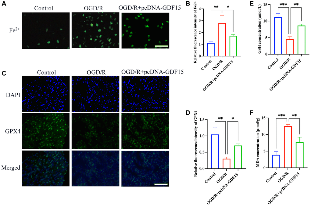 pc-DNA-GDF15 significantly inhibited the ferroptosis in OGD/R-treated H9C2 cells. (A, B) The Fe2+ level in cells were validated (bar: 100 μm, magnification: 100×); (C, D) The relative expression intensity of GPX4 in the cells were evaluated (bar: 200 μm, magnification: 40×); (E, F) The levels of GSH and MDA in the cells were measured. *P **P ***P 