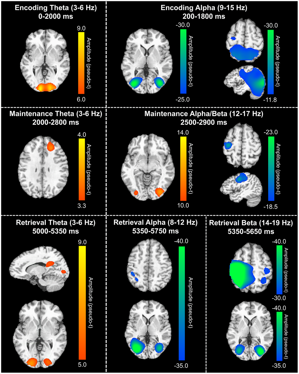 Grand-averaged beamformer images (pseudo-t) across all participants for theta (left) and alpha/beta (right) bands. During the encoding phase (top), there were increases in theta band amplitude relative to baseline in the primary visual cortex and decreases in alpha band activity (i.e., more negative relative to baseline) in the lateral occipital cortices, parietal cortices, and left hemisphere frontal cortex (including language areas). During the maintenance phase (middle), theta increases were limited to the right dlPFC and decreased alpha/beta activity in the left hemisphere frontal cortex (relative to baseline) was largely sustained. Additionally, a decrease in alpha/band activity relative to the baseline was observed in the lateral occipital cortices during the maintenance phase. During the retrieval phase (bottom), theta band activity increased in the right posterior cingulate gyrus and bilateral primary visual cortices, while alpha activity decreased (i.e., became more negative) in the lateral occipital cortices, left SMG, and left angular gyrus. Finally, decreased beta activity (i.e., more negative relative to baseline) in the bilateral primary motor cortices, lateral occipital cortices, and right superior parietal lobe was observed.