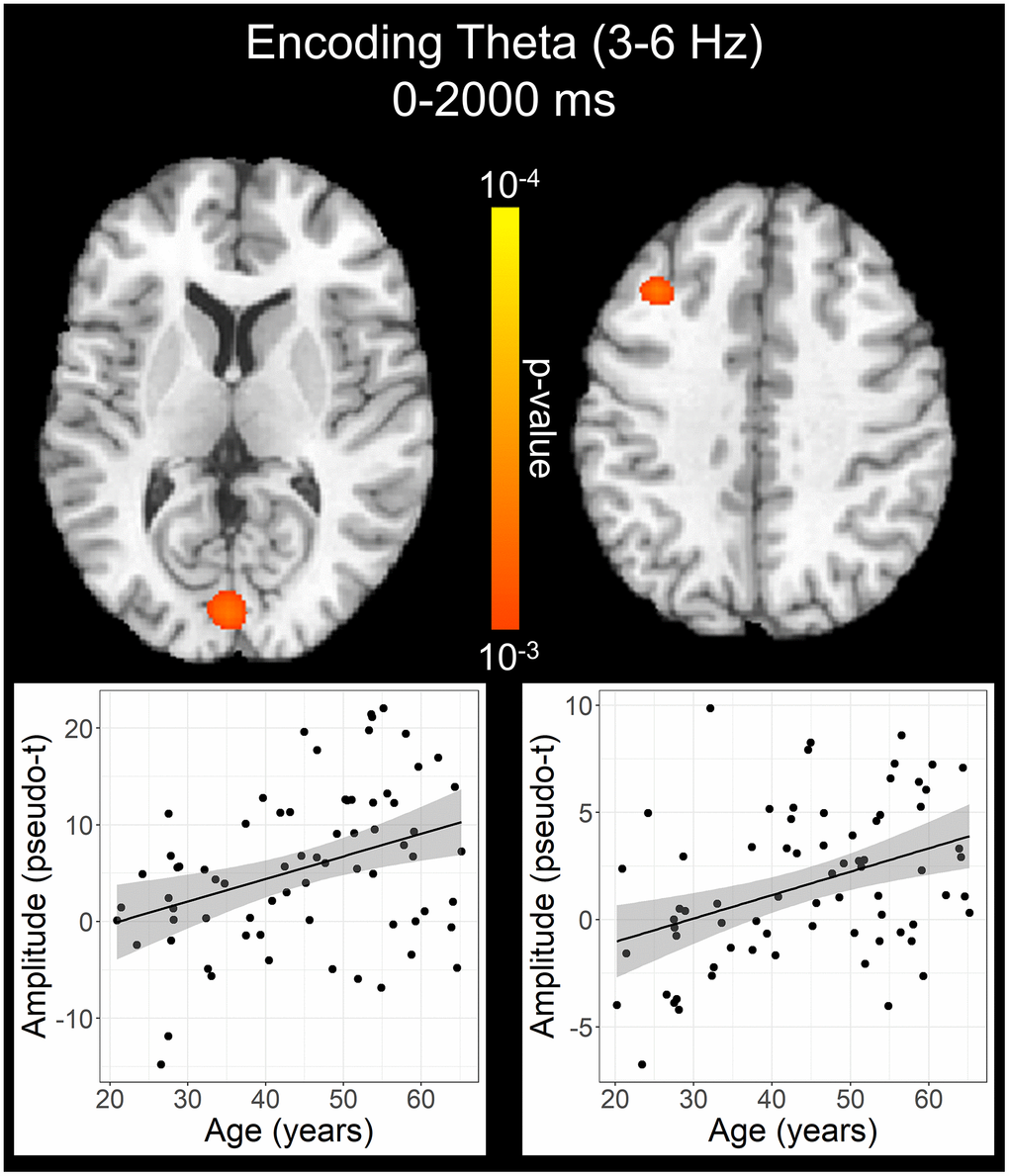 Effect of age on theta oscillations during the encoding phase. Whole-brain linear regression analysis revealed that theta activity increased in the left primary visual cortex and left dlPFC with older age. Linear regression plots of peak voxel pseudo-t values are shown as a function of age. Lines of best-fit and 95% CI (shaded area) are overlaid.