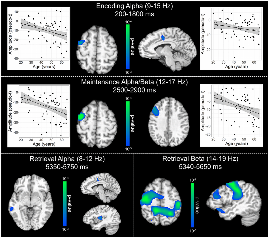 Effect of age on alpha and beta oscillations during the encoding, maintenance, and retrieval phases. Whole-brain linear regression analyses testing for age-related changes in alpha (encoding and retrieval), alpha/beta (maintenance), and beta (retrieval) are shown during the encoding (top), maintenance (middle), and retrieval bottom) phases. During encoding (top), decreases in alpha activity became significantly stronger (i.e., more negative relative to baseline), as a function of age, in prefrontal cortical regions and anterior cingulate. Additionally, age-related alterations in alpha and beta activity during the maintenance period (middle) were found in the left prefrontal cortices, while age-related effects during retrieval (bottom) were observed across a diverse set of brain regions that have been implicated in working memory processing (i.e., frontal, temporal, and parietal cortices). Beyond statistical maps, linear regression plots of peak voxel pseudo-t values are shown as a function of age for encoding and maintenance peaks. Lines of best-fit and 95% CI (shaded area) are overlaid.