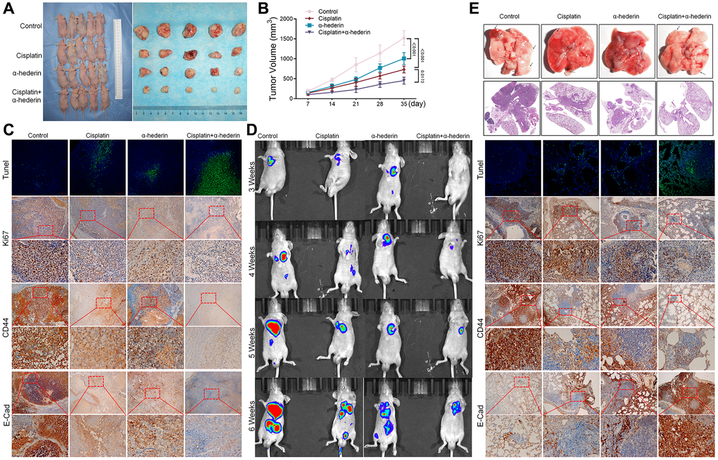 α-Hederin decreases A549/DPP cell growth in vivo. (A) Representative images of xenograft tumors isolated from nude mice in the different groups. (B) Tumor sizes in the different groups. (C) Representative images of Tunel, Ki-67, CD44, E-Cad staining isolated from nude mice xenograft tumor tissues in the different groups. (D) Live imaging showing metastasis of A549/DPP cells of an intravenous tail injection with α-Hederin in different weeks. (E) Representative images of orthotopic tumor model isolated from nude mice in the different groups and HE, Tunel, Ki-67, CD44, E-Cad staining in orthotopic lung tissue. (n = 5). Data are shown as mean ± SD, One-way ANOVA, *P **P ***P 