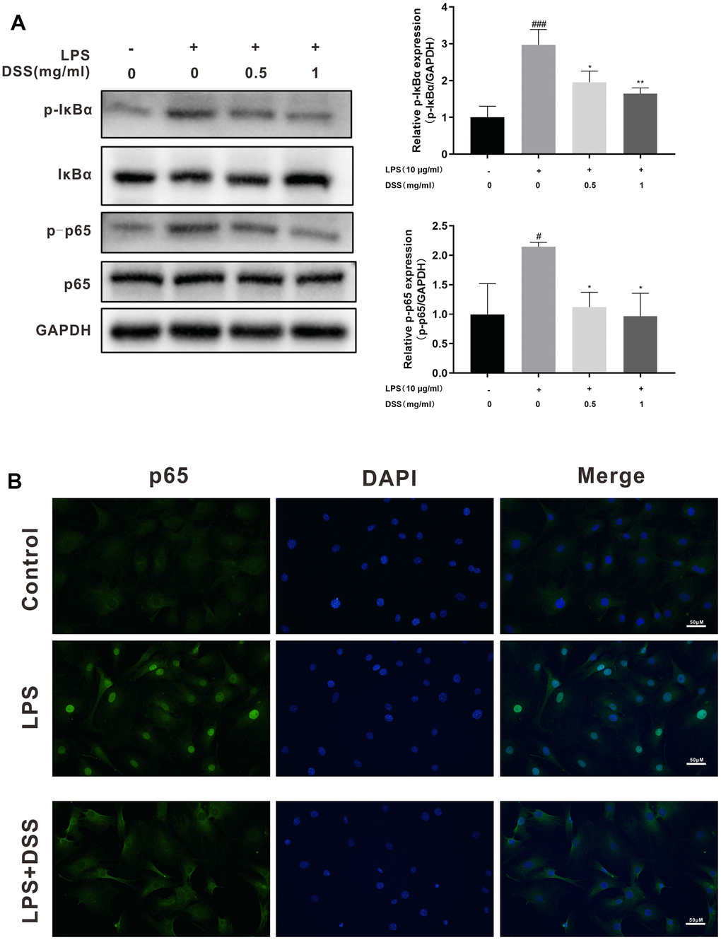 DSS inhibited LPS mediated activation of the NF-κB pathway. The chondrocytes were pretreated with DSS for 24 h and stimulated with or without LPS for 2 h. (A) The protein levels of p-IκBα, IκBα, p-p65 and p65 were assessed by western blot. (B) The nuclei translocation of p65 was analyzed by the immunofluorescence staining. #p ###p *p **p 