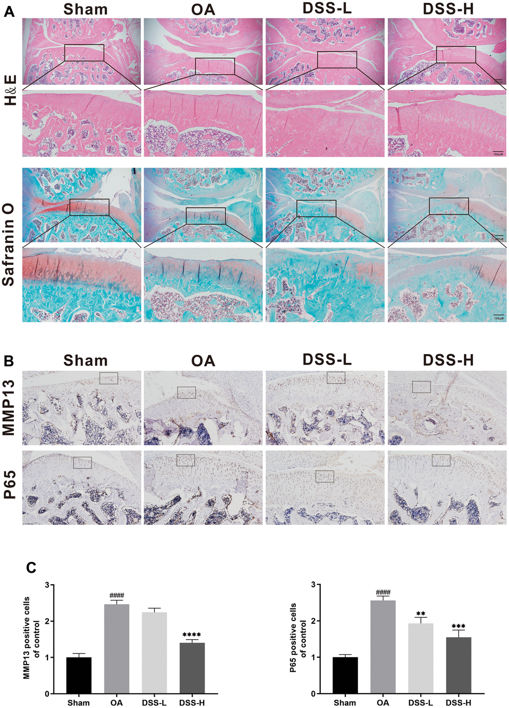 DSS ameliorated OA progression in a rat OA model in vivo. (A) Representative H&E and Safranin O staining of cartilage and synovitis from different experimental groups. (B) Immunohistochemical staining of MMP13 and P65 was employed to evaluate the effect of DSS on the cartilage. (C) Quantitative analysis of positive cells in cartilage. ####p **p ***p ****p 