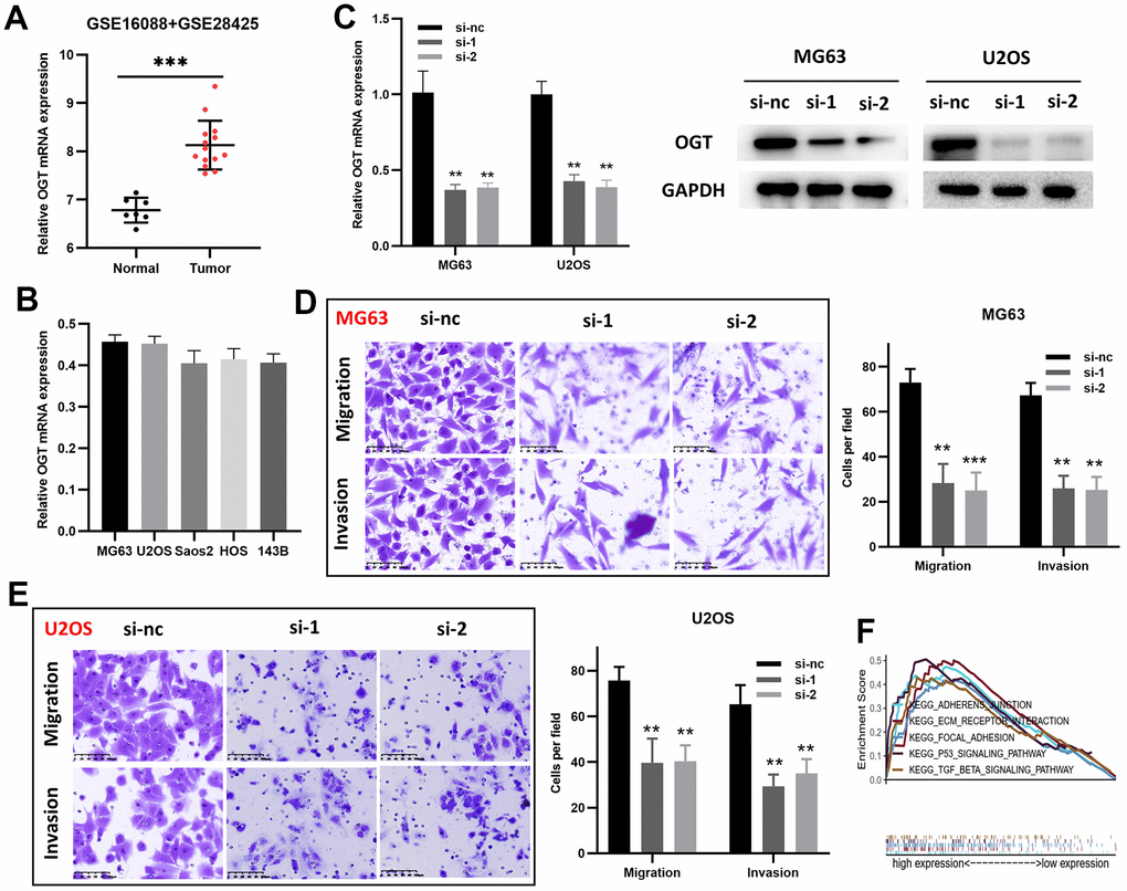 OGT knockdown inhibits the migration and invasion capability of osteosarcoma cells. (A) OGT expression in normal bone tissues and osteosarcoma tissues (GSE16088 and GSE28425). (B) OGT mRNA expression level in osteosarcoma cells. (C) OGT knockdown in MG63 and U2OS cells was confirmed using RT-PCR and WB. (D, E) Migration and invasion capability of MG63 and U2OS cells were significantly weakened by the downregulation of OGT expression (**p F) KEGG pathway analysis of OGT in osteosarcoma.