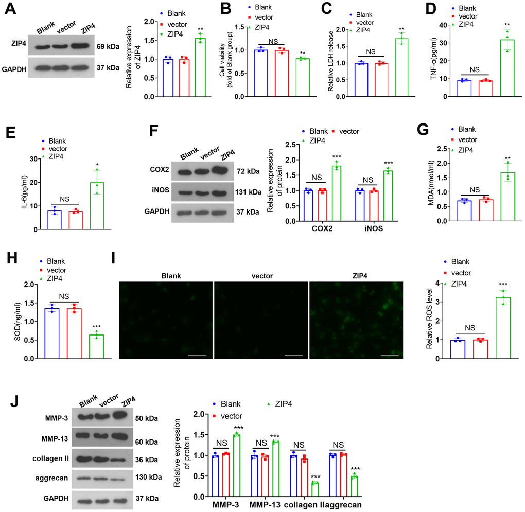 ZIP4 upregulation aggravates ECM degradation in NP cells. (A) NP cells transfected with the vector and ZIP4 overexpression plasmids. Western blot experiments were used to check the transfection efficiency. (B) CCK8 assay was used for evaluating cell viability. (C) The cytotoxicity detection kit evaluated LDH release in NP cells following IL-1β treatment. (D, E) TNF-α and IL-6 profiles in the cells verified by ELISA. (F) Western blot showing the expression levels of COX2 and iNOS in the cells. (G–I) MDA, SOD, and ROS levels in the cells were determined. Scale bar=100 μm. (J) MMP-3, MMP-13, collagen II and aggrecan levels in the cells confirmed by western blot. N=3. NS P>0.05, *P (vs. vector).