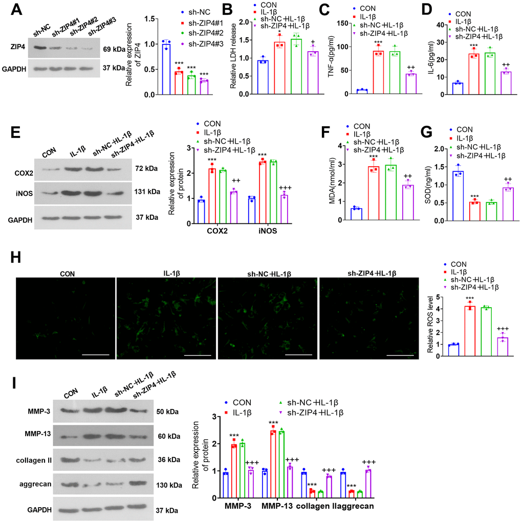 ZIP4 knockdown mitigates ECM degradation in NP cells treated with IL-1β. (A) NP cells were transfected with sh-NC and sh-ZIP4. Western blot analysis confirmed the profile of ZIP4 in transfected NP cells. Subsequent to transfection, the cells underwent IL-1β (20 ng/ml) treatment for a duration of 24 hours. (B) LDH release in NP cells was evaluated. (C, D) ELISA was used to determine TNF-α and IL-6 expression in the cells. (E) Western blot verified COX2 and iNOS expression in the cells. (F–H) Alterations in MDA, SOD, and ROS levels in NP cells were detected. Scale bar=100 μm. (I) MMP-3, MMP-13, collagen II, and aggrecan profiles in the cells checked by western blot. N=3. *P (vs. CON); +P (vs. sh-NC+IL-1β).