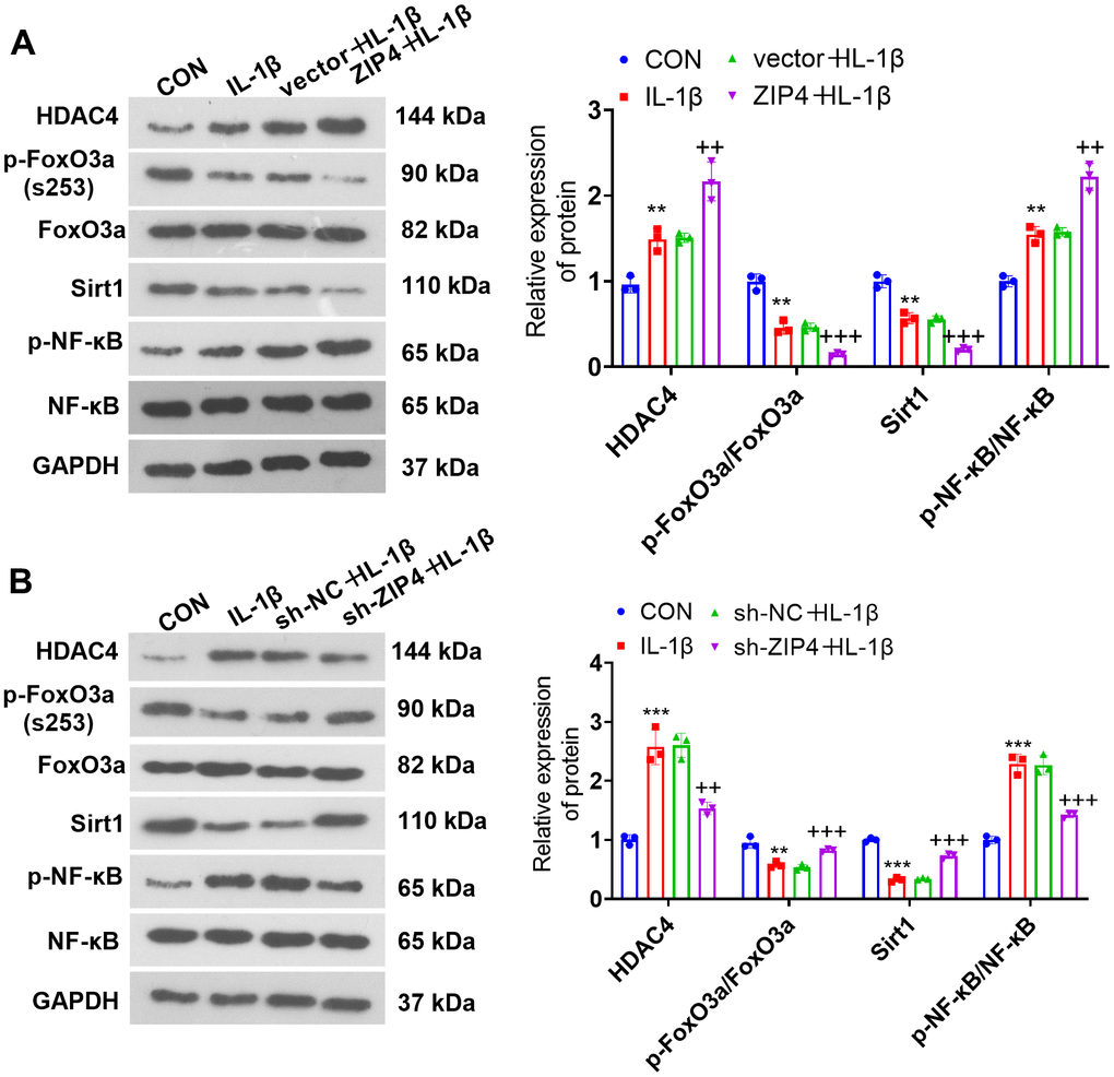 The influence of ZIP4 on the HDAC4-FoxO3a pathway. (A, B) Western blotting was implemented to determine the HDAC4, FoxO3a, Sirt1 and NF-κB profiles in NP cells after IL-1β treatment. N=3. **P (vs. CON); ++P (vs. vector+IL-1β or sh-NC+IL-1β).