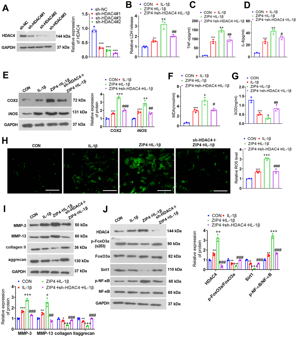 HDAC4 overexpression abates the damage-boosting function mediated by ZIP4 overexpression. (A) NP cells were transfected with the sh-NC or sh-HDAC4 overexpression plasmid. Western blot confirmed the transfection efficiency. The HDAC4 overexpression plasmid and ZIP4 overexpression plasmid were cotransfected into NP cells, which underwent 20 ng/ml IL-1β treatment for a 24-hour period in the following step. (B) The LDH level in NP cells treated with IL-1β. (C, D) The profiles of inflammatory factors in the cells verified by ELISA. (E) COX2 and iNOS profiles in the cells checked via western blot. (F–H) MDA, SOD, and ROS levels in the cells were detected. Scale bar=100 μm. (I) MMP-3, MMP-13, collagen II, and aggrecan profiles in the cells examined by western blot. (J) Western blot verified HDAC4, FoxO3a, Sirt1 and NF-κB profiles in NP cells undergoing IL-1β treatment. N=3. **P (vs. CON); +P (vs. IL-1β); #P (vs. ZIP4+IL-1β).