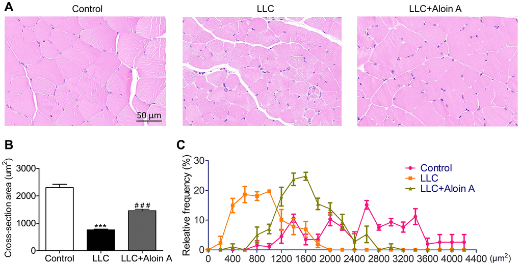 Effect of Aloin A on muscle histology in mice bearing lung tumor. (A) Representative images of hematoxylin and eosin (H&E) of transversal sections of the muscle. Scale bars: 50 μm. (B) The quantification of cross-sectional area (CSA) in muscle fibers. (C) Relative frequency of muscle fibers. The values are shown as the mean ± SEM (n = 3). ***P ###P 