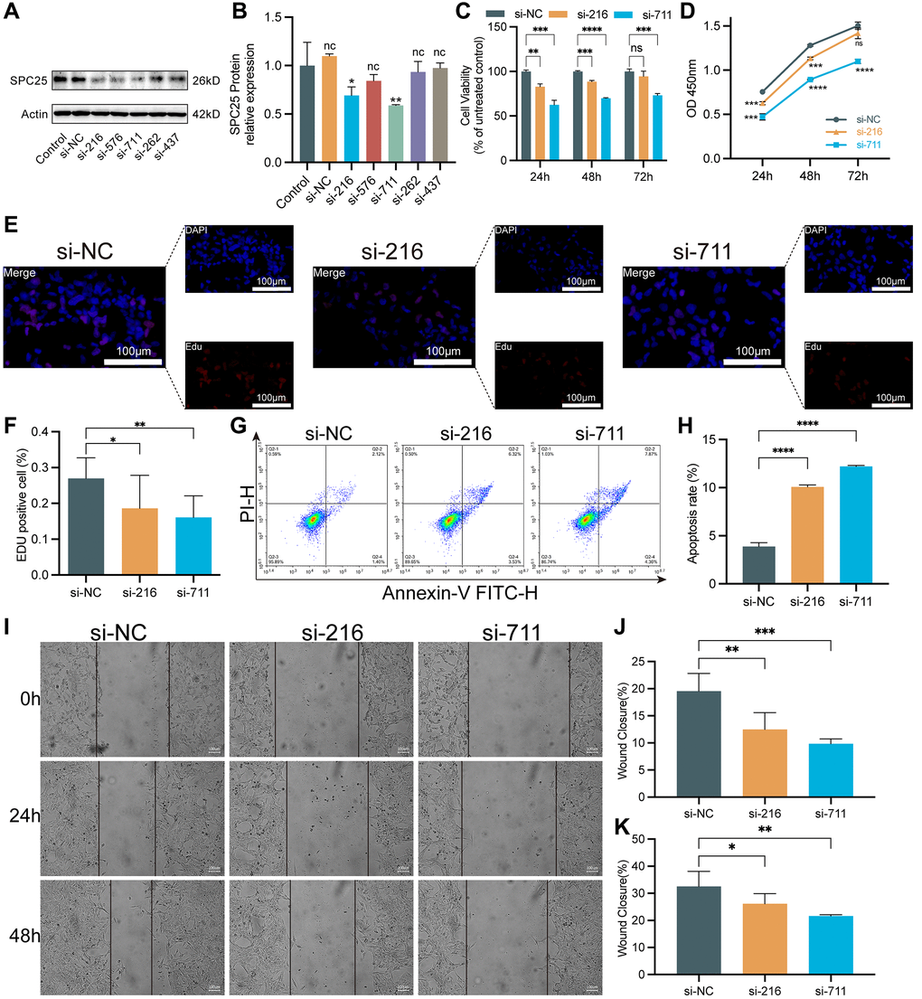 The impact of knocking down SPC25 on LUAD. (A, B) An analysis of Western blotting confirmed the success of SPC25-siRNAs transfection into H1975 cells and their ability to interfere with gene expression. (C, D) CCK-8 assay evaluated tumor cell proliferation activity. (E, F) EdU staining of H1975 cells and EdU-positive cell proportion. (G, H) The effect of SPC25 knockdown on apoptosis of the H1975 cells as detected by flow cytometry. (I–K) Representative images and quantitative analysis of wound healing measurements in LUAD cells. (***p **p *p 