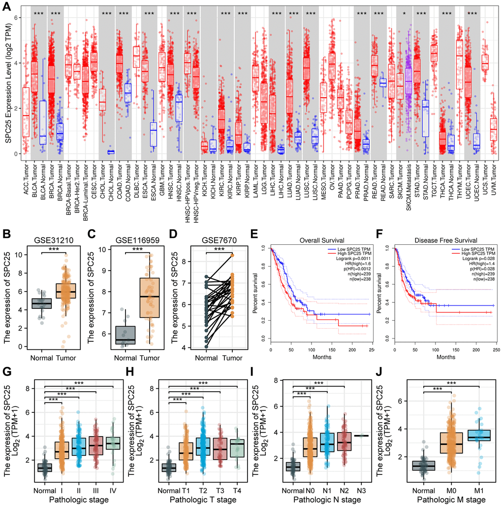 SPC25 as a novel therapeutic and prognostic biomarker and its