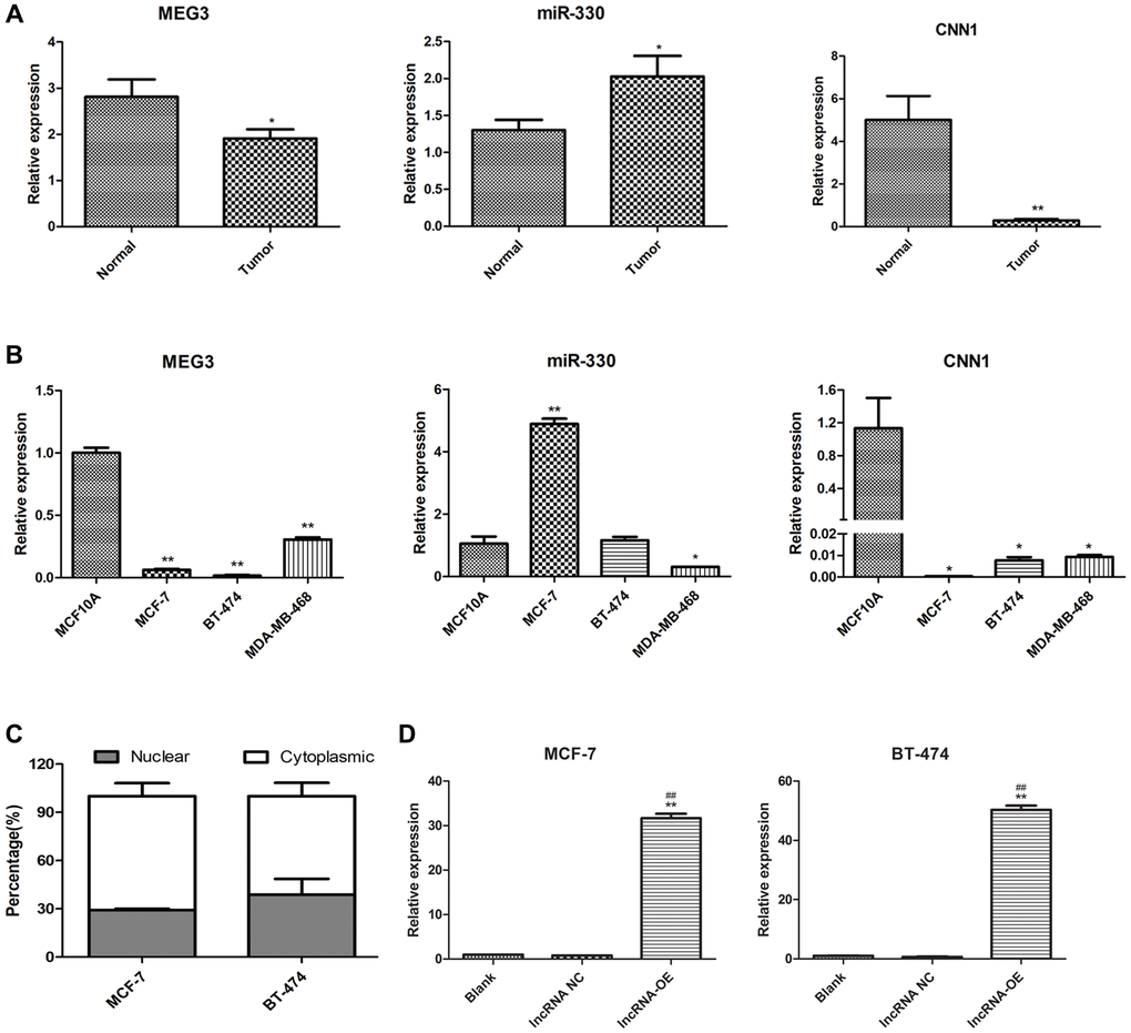 Expression of lncRNA MEG3, and CNN1 in breast cancer tissues and cells. (A) qRT-PCR detected the expression of lncRNA MEG3, miR-330, and CNN1 in tumor and normal tissue of our cohort. *P **P B) mRNA expression of miR-330, lncRNA MEG3, and CNN1 in MCF10A, MCF-7, BT-474, and MDA-MB-468 cells. *P **P C) Subcellular location of lncRNA MEG3 in MCF-7 and BT-474 cells. (D) lncRNA MEG3 was overexpressed in MCF-7 and BT-474 cells. lncRNA MEG3 expression was detected by qRT-PCR. **P ##P 