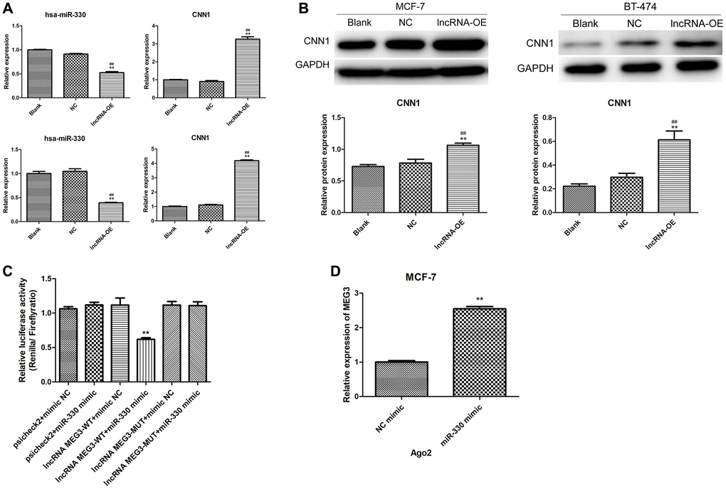 Validation of interaction among lncRNA MEG3, miR-330 and CNN1. (A) Effect of lncRNA MEG3 overexpression on miR-330 expression and CNN1 mRNA expression. Up panel, MCF-7 cells; below panel, BT-474 cells. (B) Effect of lncRNA MEG3 overexpression on CNN1 protein expression. **P ##P C) Luciferase reporter assay. **P D) lncRNA MEG3 binds to miR-330 by RIP assay. **P 