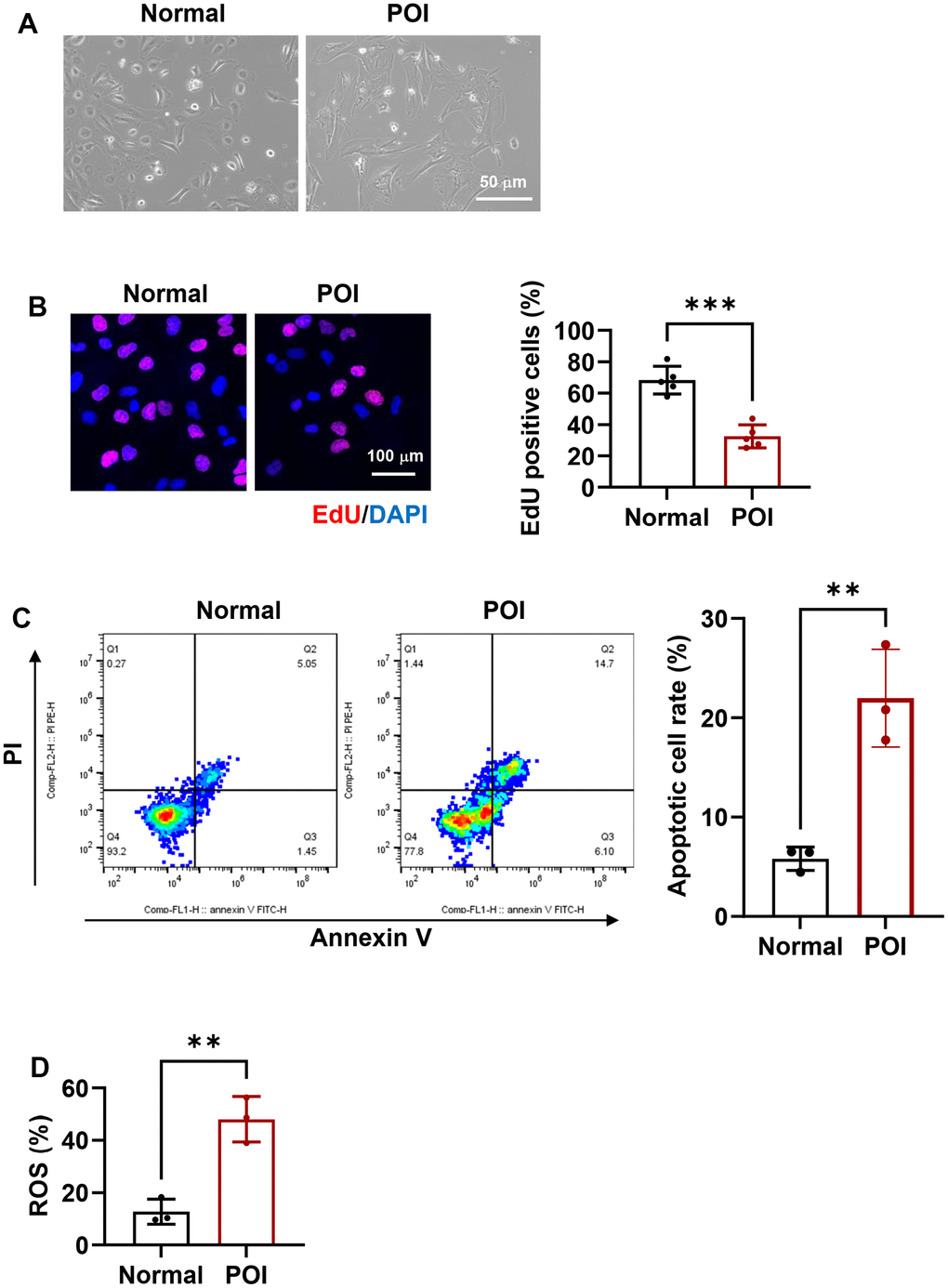 Morphological and functional characteristics of granulosa cells (GCs) in premature ovarian insufficiency (POI) patients and normal controls. (A) Microscopic images depicting the morphology of GCs. Scale bar, 50 μm. (B) Representative immunofluorescence (IF) staining and analysis of cell proliferation in GCs (n = 5). Scale bar, 100 μm. (C) Flow cytometry analysis of apoptotic rates in GCs (n = 3). (D) Analysis of reactive oxygen species (ROS) production in GCs. **p 