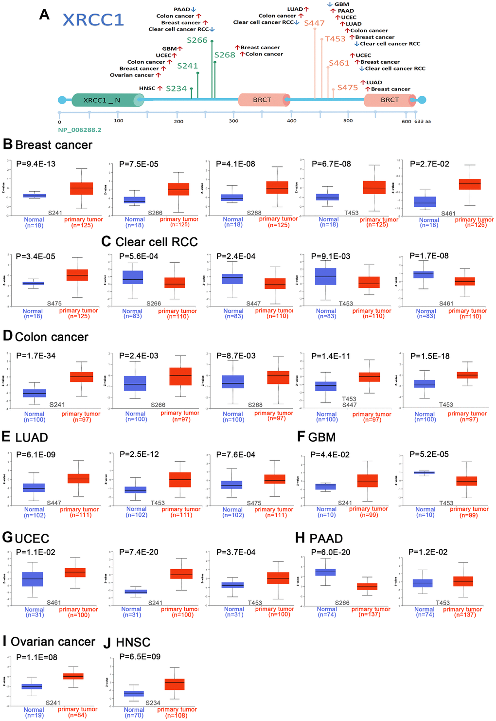 We utilized the UALCAN tool to compare the expression status of XRCC1 phosphoprotein (NP