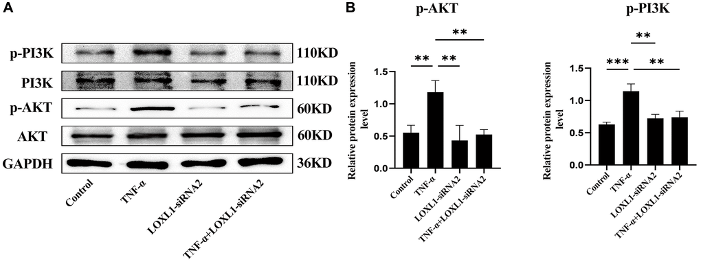 Knockdown of LOXL1 may inhibit the inflammatory response in RA synoviocytes by suppressing the PI3K/AKT cell signaling pathway. (A) p-PI3K, PI3K, p-AKT and AKT protein levels was detected using western blot. (B) Quantitative analysis of western blot results. *P **P ***P 