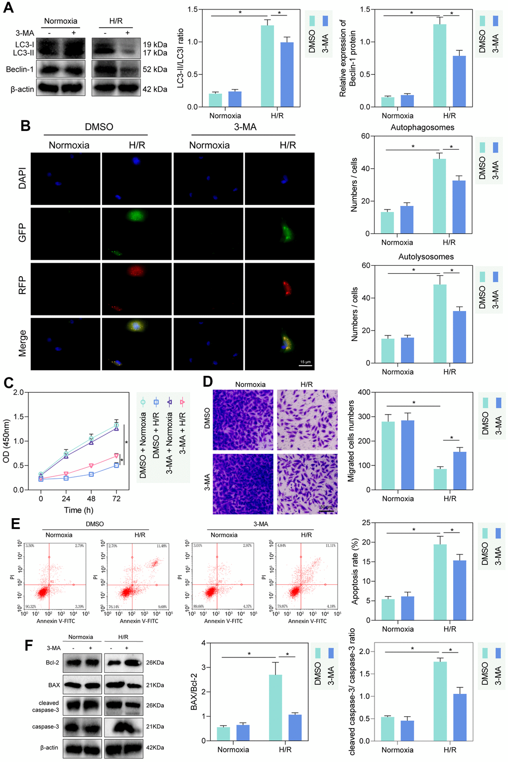 H/R enhanced PMVEC injury via autophagy. (A) Western blot showing the expression of LC3-I/LC3-II and Beclin-1 under treatment of 3-MA, normoxia, hypoxia or H/R. (B) The mRFP-GFP-LC3 dual fluorescence system was used to trace autophagy formation under treatment of 3-MA, normoxia, hypoxia or H/R. (C) CCK-8 assay showing changes in proliferation of cells treated with 3-MA or under normoxia, hypoxia or H/R. (D) Transwell assay showing PMVEC migration (magnification, 200 ×; scale bar = 50 μm) under treatment of 3-MA, normoxia, hypoxia or H/R. (E) Flow cytometry showing apoptosis under treatment of 3-MA, normoxia, hypoxia or H/R. (F) Western blot showing Bcl-2 and Bax, cleaved caspase-3 and caspase-3 expression under treatment of 3-MA, normoxia, hypoxia or H/R. Measurement data are expressed as mean ± standard deviation. Differences between 2 groups of data were compared using an unpaired t-test. Two-way ANOVA was used for data comparison at different time points. * p 