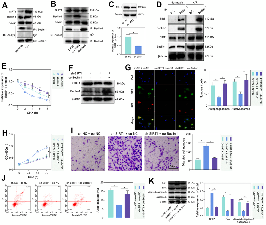 SIRT1 deacetylated Beclin-1 to enhance autophagy and injury of H/R-treated PMVECs. (A) Western blot showing the expression of SIRT1, Beclin-1, and Beclin-1-Ac under normoxia or H/R. (B) Western blot showing expression of Beclin-1 and Beclin-1-Ac under treatment with SRT2104 or Selisistat. (C) Western blot showing SIRT1 expression in PMVECs transfected with sh-SIRT1. (D) Detection of the interaction of SIRT1 with Beclin-1 in PMVECs with oe-SIRT1 under normoxia or H/R condition by Co-IP assay. (E) Beclin-1 protein stability analysis based on CHX treatment. (F) Western blot showing SIRT1, Beclin-1, and Beclin-1-Ac expression in H/R-treated PMVECs with oe-Beclin-1 and sh-SIRT1. (G) The mRFP-GFP-LC3 dual fluorescence system was used to trace autophagy formation after transfection of sh-SIRT1 or oe-Beclin-1 (magnification, 400 ×; scale bar = 25 μm). (H) Detection of changes in cell proliferation by CCK-8 assay after transfection of sh-SIRT1 or oe-Beclin-1. (I) Detection of PMVEC migration by Transwell assay (magnification, 200 ×; scale bar = 50 μm) after transfection of sh-SIRT1 or oe-Beclin-1. (J) Detection of apoptosis by flow cytometry after transfection of sh-SIRT1 or oe-Beclin-1. (K) Detection of Bax, Bcl-2, cleaved caspase-3 and caspase-3 expression by Western blot after transfection of sh-SIRT1 or oe-Beclin-1. Measurement data are expressed as mean ± standard deviation. Differences between 2 groups of data were compared using an unpaired t-test. Changes between multiple groups were compared using one-way ANOVA and Tukey’s multiple comparison test. Two-way ANOVA was used for data comparison at different time points. * p 