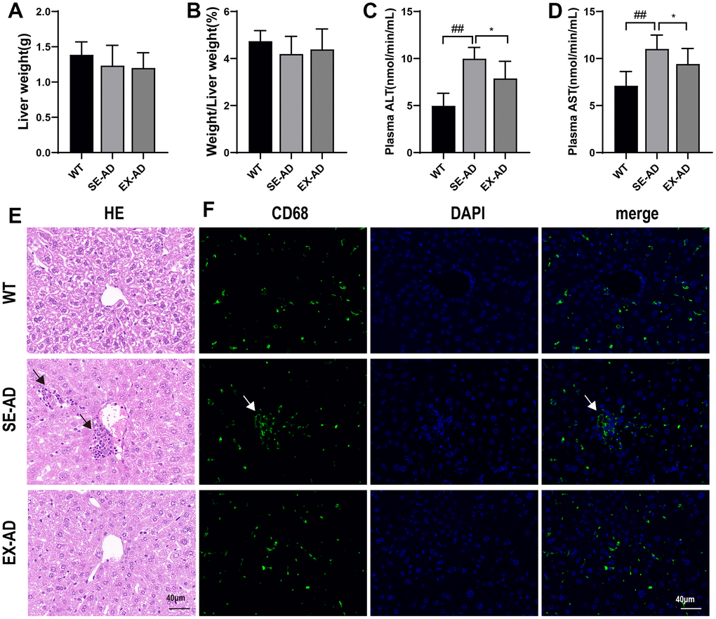 AD mice with liver damage that was alleviated after exercise. (A) Weights of the mouse livers (n = 8 per group). (B) Ratios of the mouse livers to body weights (n = 8 per group). (C) Serum glutathione aminotransferase contents (n = 6 in each group). (D) Serum glutathione aminotransferase contents (n = 6 in each group). (E) Representative images of the liver HE staining, with the black arrows indicating the abnormally aggregated Kupffer cells (n = 4 in each group). (F) Representative images of the liver CD68 immunofluorescence staining, with the white arrows indicating the abnormally aggregated Kupffer cells (n = 4 in each group). The data are expressed as means ± SDs. ## p 
