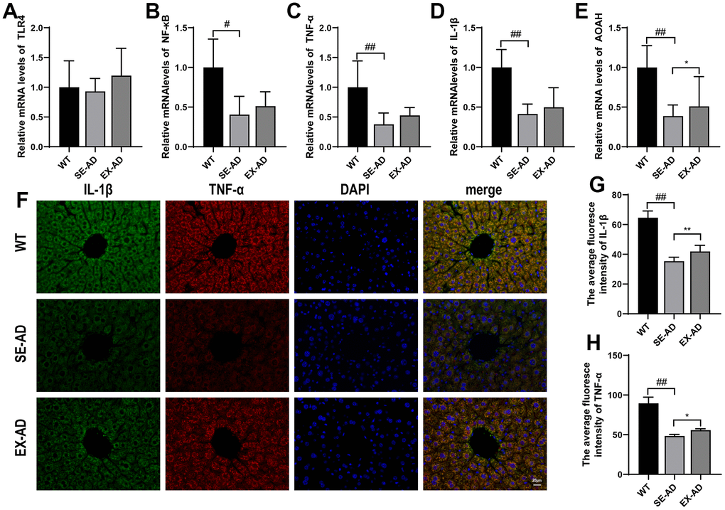 Inflammation-related factors and AOAH expression in the animals’ livers. (A) TLR4 mRNA relative expressions. (B) NF-κB mRNA relative expressions. (C) TNF-α mRNA relative expressions. (D) IL-1β mRNA relative expressions. (E) AOAH mRNA relative expressions (n = 6 in each group). (F) Representative images of IL-1β and TNF-α immunofluorescence staining in the animals’ livers. (G) Quantitative statistics of the mean fluorescence intensity of IL-1β. (H) Quantitative statistics of the mean fluorescence intensity of TNF-α (n = 4 in each group). The data are expressed as means ± SDs. # p 