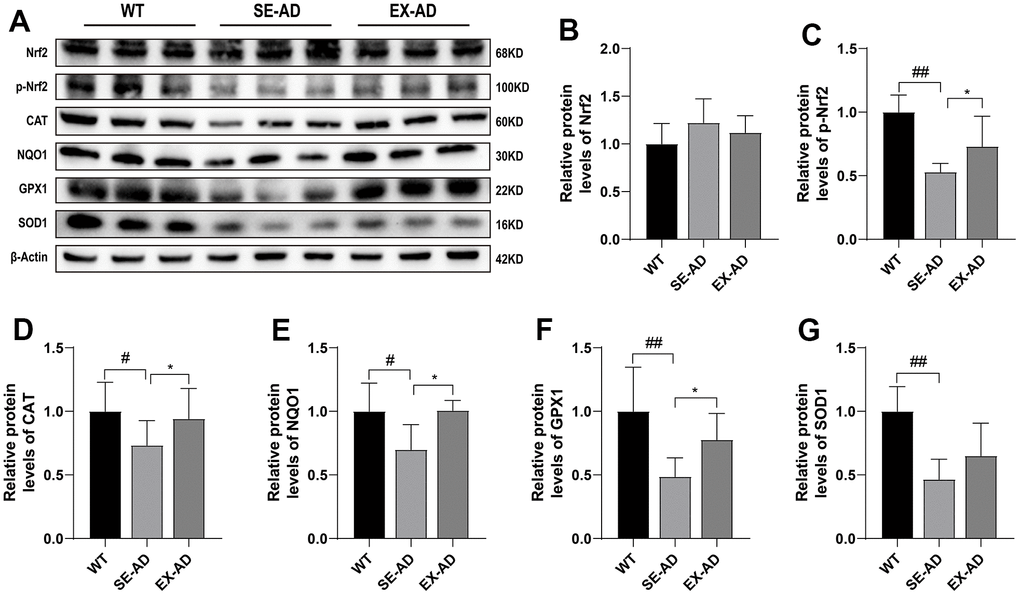 Nrf2 and antioxidant protein expression in the mouse livers. (A) Representative images of the protein immunoblots. (B) Relative contents of Nrf2 protein. (C) Relative contents of phosphorylated Nrf2 protein. (D) Relative contents of CAT protein. (E) Relative contents of NQO1 protein. (F) Relative contents of GPX1 protein. (G) Relative contents of SOD1 protein (n = 5 for each group). The data are presented as means ± SDs. # p 