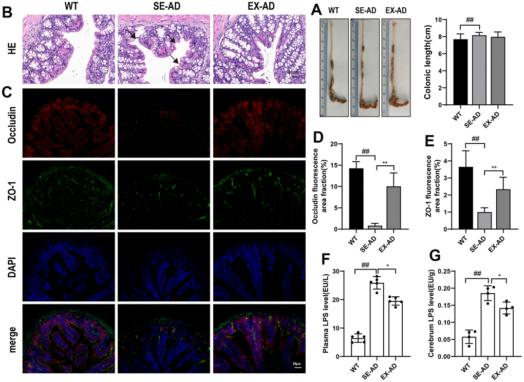 Mouse intestinal barrier and LPS displacement. (A) Representative images and length statistics of the animals’ colons (n = 12 per group). (B) Representative images of the colon HE staining (n = 4 per group). (C) Representative images of the intestinal ZO-1 and occludin immunofluorescence (n = 4 per group). (D) Quantitative statistics of the occludin fluorescence area. (E) Quantitative statistics of the ZO-1 fluorescence area. (F) LPS contents in serum samples (n = 6 per group). (G) LPS contents in the animals’ brains (n = 4 per group). The data are expressed as means ± SDs. # p 