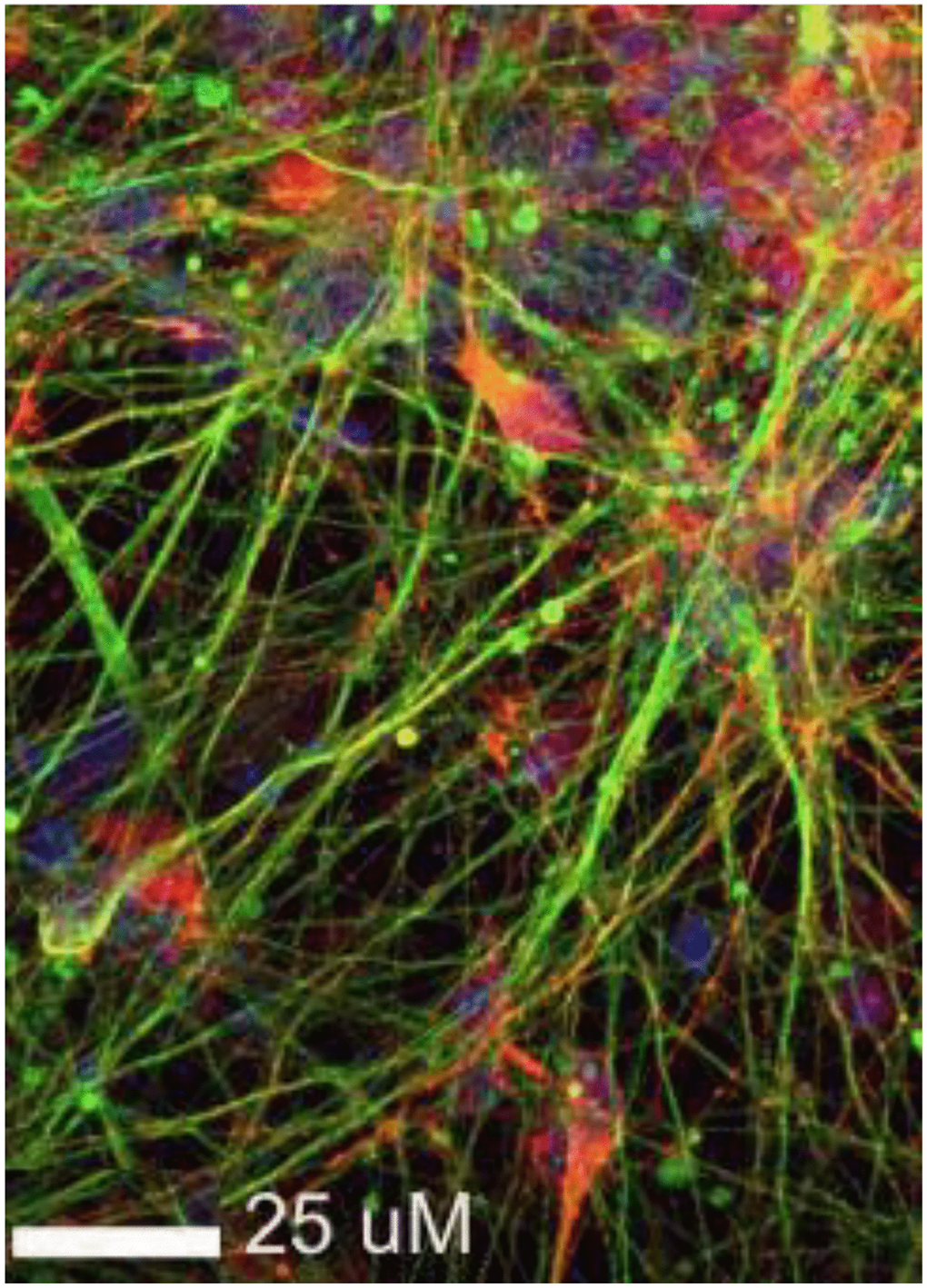 Dopaminergic neurons differentiated from induced pluripotent stem cells in vitro. Some processes that may contribute to neuron death can be assessed and modulated in vitro although those that are linked to aging are more difficult to replicate. Shown are neurons immunostained for BIII-tubulin (green) and alpha-synuclein (red).
