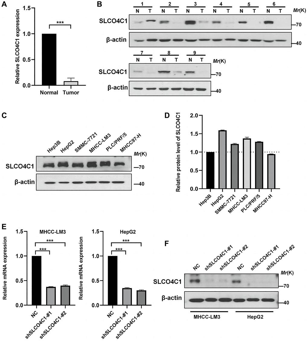 Expression of SLCO4C1 in HCC tissues and cell lines. (A) 30 SLCO4C1 mRNA expression levels in paired HCC tissues versus normal tissues. (B) 9 protein expression levels of SLCO4C1 in paired HCC tissues versus normal tissues. (C, D) The protein expression levels of SLCO4C1 in 6 common HCC cell lines. (E) The mRNA expression levels of SLCO4C1 in the HepG2 and MHCC-LM3 cell lines. (F) Protein expression levels of SLCO4C1 in HepG2 and MHCC-LM3 cells transfected with shRNA. *P **P ***P 