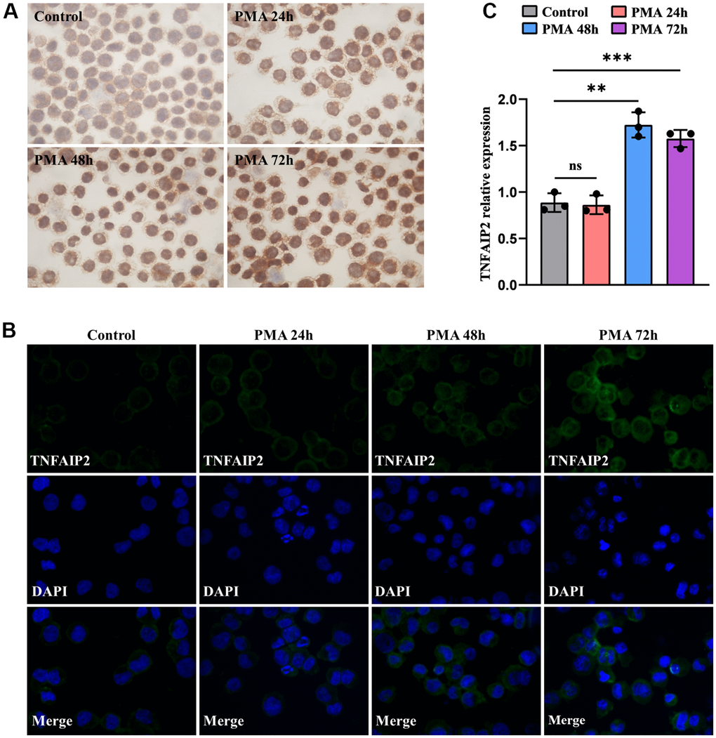 The expression levels of TNFAIP2 mRNA and protein were increased upon monocytic leukaemia cell differentiation induced by PMA. (A) Immunocytochemistry was used to evaluate TNFAIP2 protein expression in MOLM-13 cells. (B) The immunofluorescence intensity of TNFAIP2 protein in THP-1 cells. (C) qRT-PCR analysis of TNFAIP2 mRNA expression in THP-1 cells. Normal distribution, ANOVA test, ** P P 